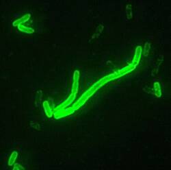 Das Pestbakterium Yersinia pestis im Fluoreszenz-Mikroskop